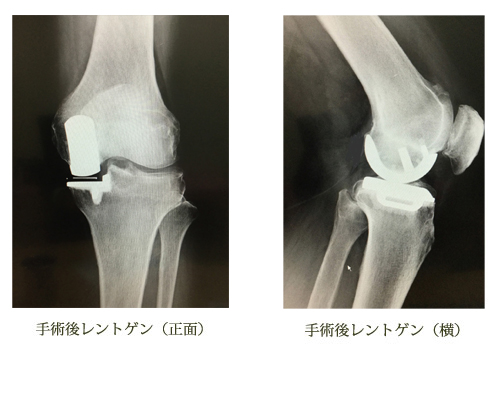 浜口 英寿 先生 第109回 ひざが痛みだしたら危険信号 違和感があれば 早めに治療を始めましょう 人工関節ドットコム