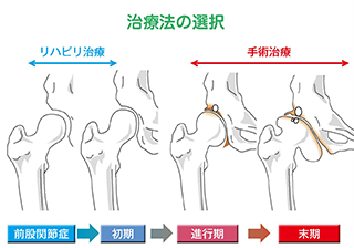 高澤 誠 先生 股関節の痛みの原因は 第132回 あきらめないで股関節の痛み 今すぐ関節の専門医に相談を 人工関節ドットコム