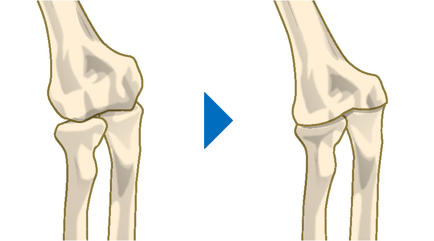 國府 幸洋 先生 肘の痛みの原因 肘や手指の痛み 腫れは 関節リウマチと上肢の治療に精通した手外科専門医に相談を 人工関節ドットコム