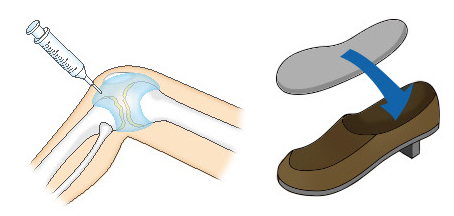 ヒアルロン酸注射と装具療法