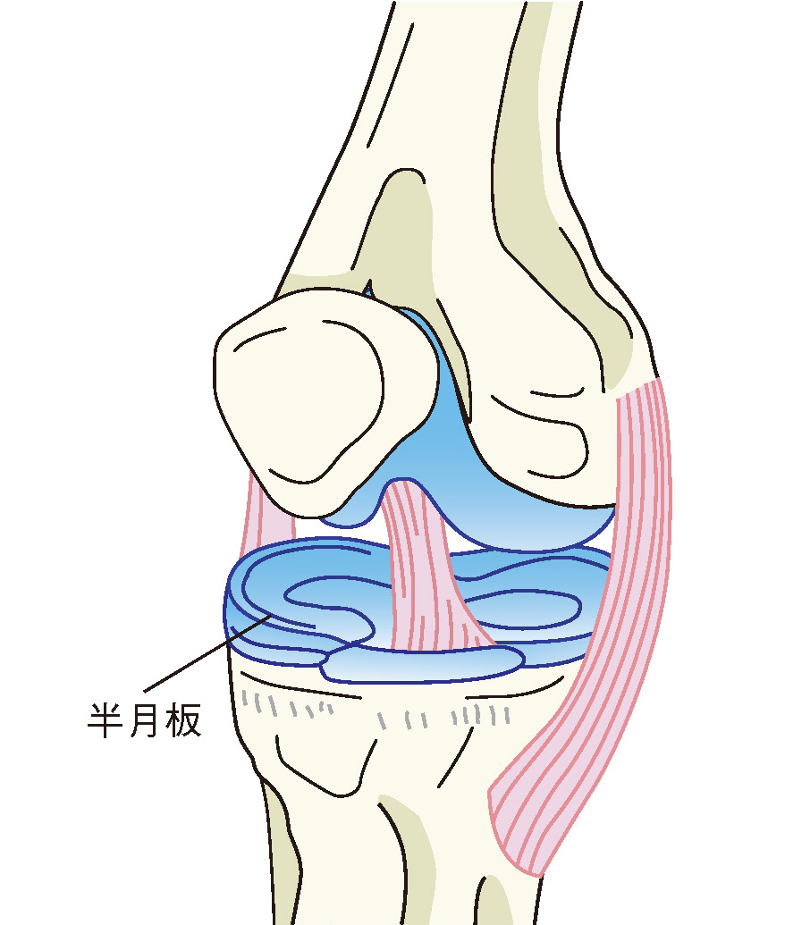 半月板