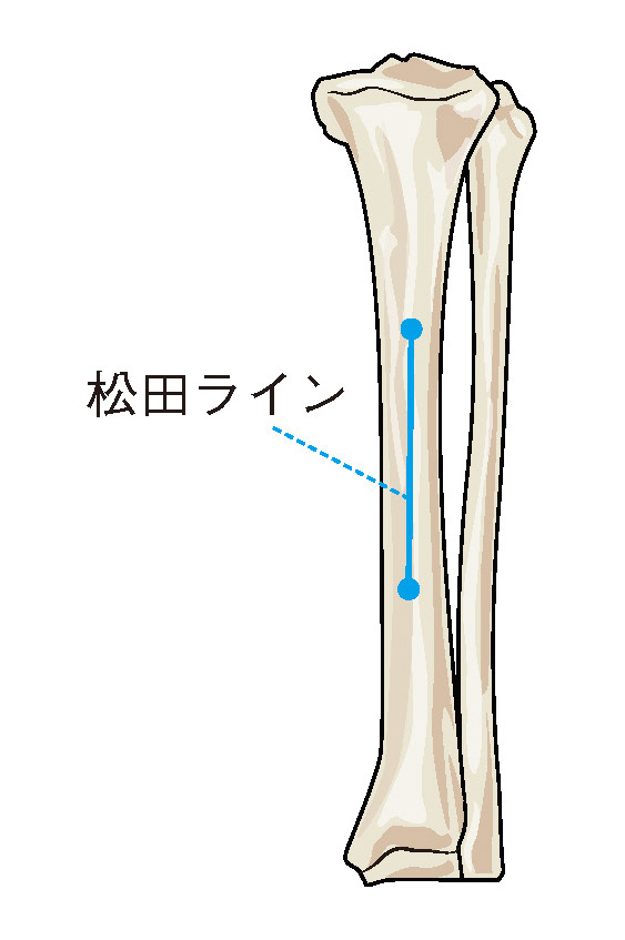 松田ライン