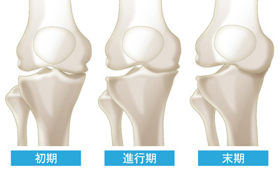 進行状況