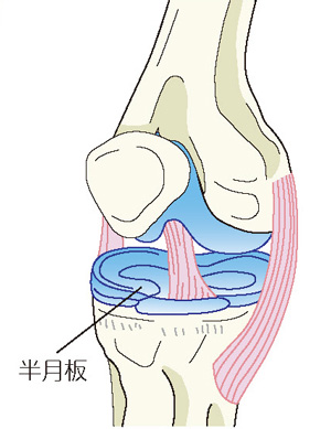 半月板