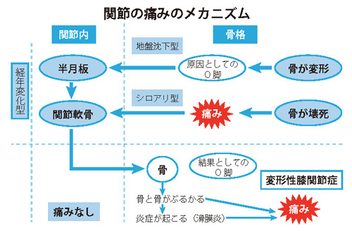 図3　関節の痛みのメカニズム