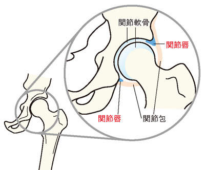 人工股関節置換術の流れ