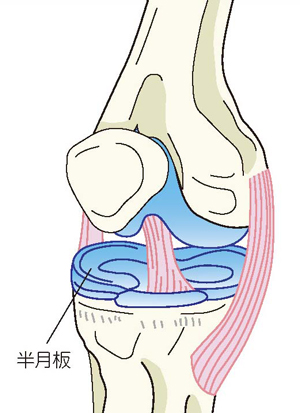 半月板