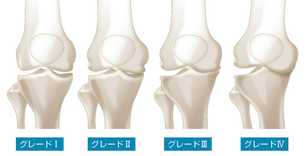 KL分類