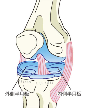 外側半月板と内側半月板