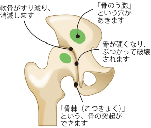 山口 仁 先生 適切な治療タイミングを逃さないためには早めの受診が肝心 第38回 我慢は禁物 重症化する前に専門医に相談し 適切なアドバイスを受けよう 健康長寿で豊かな生活を目指す 人工関節ドットコム