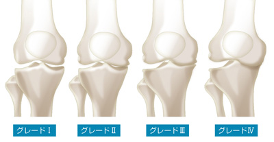 KL分類