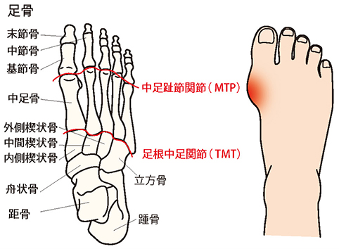 足関節のしくみと外反母趾