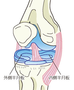 外側半月板と内側半月板