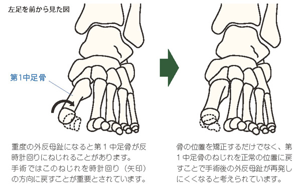 左足を前から見た図