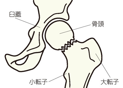 大腿骨頸部骨折