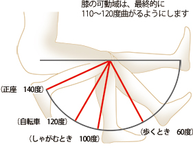 前原 一之 先生 入院期間は2週間 退院後は転倒に気をつけて 第59回 いくつになっても 自分の脚で歩きたい 生活の質を高めるための人工膝 関節置換術 人工関節ドットコム