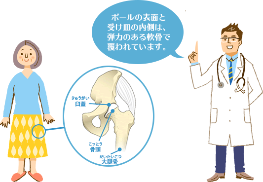 股関節のしくみ 股関節の痛み 人工関節ドットコム