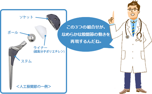 人工股関節置換術とは 人工股関節について 人工関節ドットコム